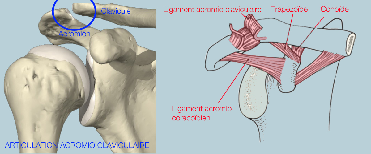 artroza deformantă a articulației acromioclaviculare)